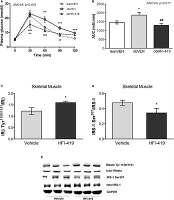 Insulin-Regulated Aminopeptidase Inhibition Ameliorates Metabolism in Obese Zucker Rats